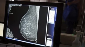 Pesquisadores brasileiros desenvolvem tecnologia para mamografia sem desconforto